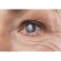 Diabetes patients are TWICE as likely to develop cataracts